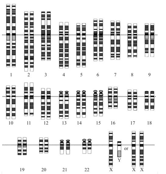 Perbedaan Kromosom Homolog dan Non-Homolog Lengkap