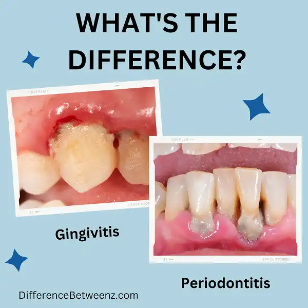 Perbedaan antara Gingivitis dan Periodontitis