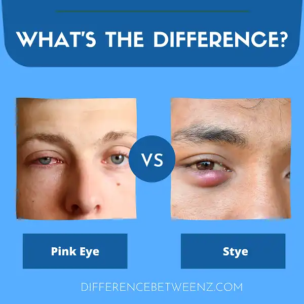 perbedaan-antara-pink-eye-dan-stye