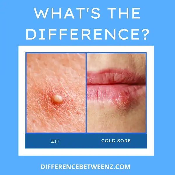 Perbedaan antara Zit dan Cold Sore